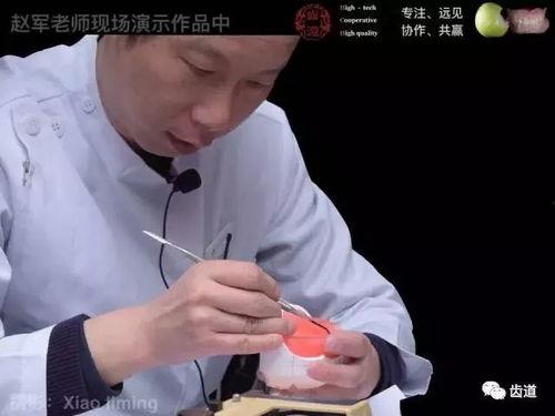 排牙视频,牙列矫正步骤全解析